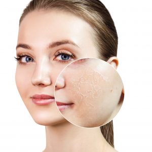 bellecour esthetique qualite peau medecine esthetique